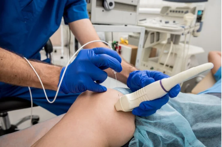 Radio Frequency Coagulation for Proctology Conditions